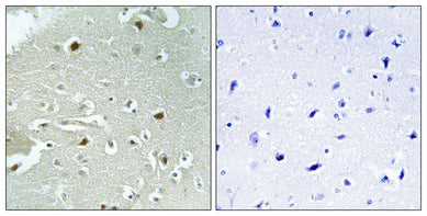 HAND1 (phospho Ser98) Rabbit Polyclonal Antibody