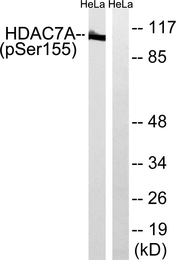 HDAC7 (phospho Ser155) Rabbit Polyclonal Antibody