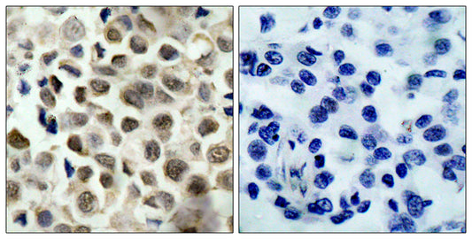 HDAC8 (phospho Ser39) Rabbit Polyclonal Antibody