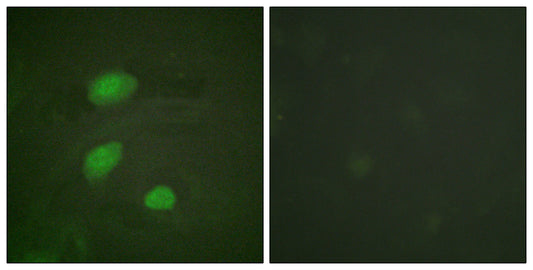 HIRA (phospho Thr555) Rabbit Polyclonal Antibody