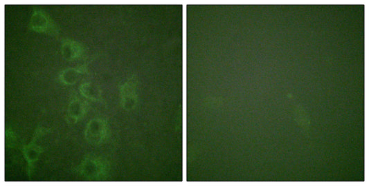 Histamine H1 Receptor (phospho Ser398) Rabbit Polyclonal Antibody