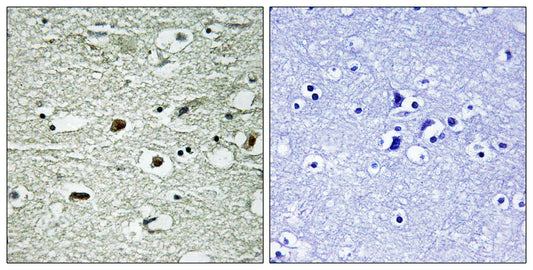 hnRNP C1/2 (phospho Ser260) Rabbit Polyclonal Antibody