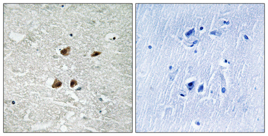HSF1 (phospho Ser121) Rabbit Polyclonal Antibody
