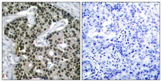 HSF1 (phospho Ser303) Rabbit Polyclonal Antibody