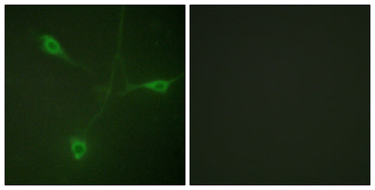 HSP90β (phospho Ser226) Rabbit Polyclonal Antibody