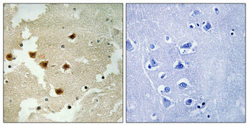 Huntingtin (phospho Ser421) Rabbit Polyclonal Antibody