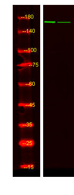 IGF-I Receptor β (phospho-Tyr980)  Rabbit Polyclonal Antibody
