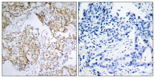 IGF-IR (phospho Tyr1161) Rabbit Polyclonal Antibody