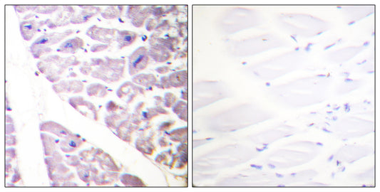 IKKα/β (phospho Ser176/177) Rabbit Polyclonal Antibody