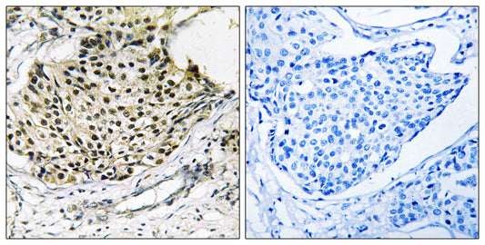 IKKγ (phospho Ser31) Rabbit Polyclonal Antibody