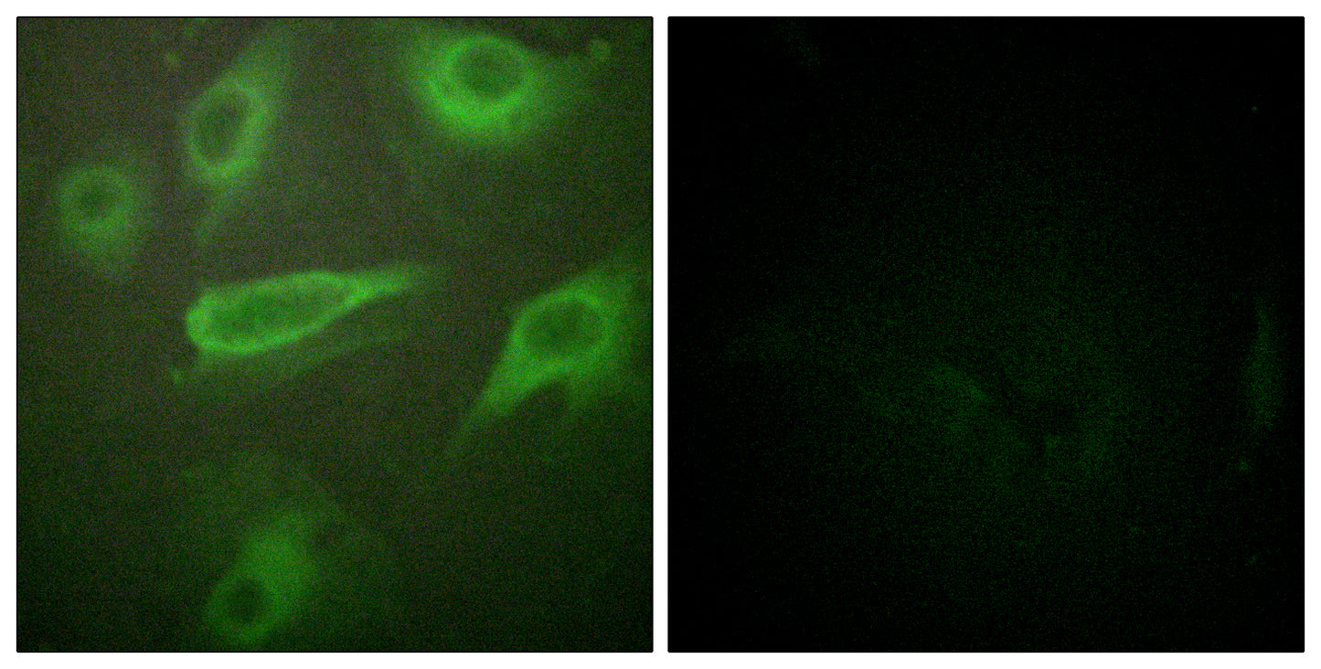 IL-4Rα (phospho Tyr497) Rabbit Polyclonal Antibody