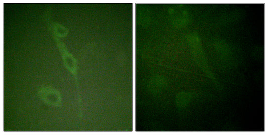 IL-7R (phospho Tyr449) Rabbit Polyclonal Antibody