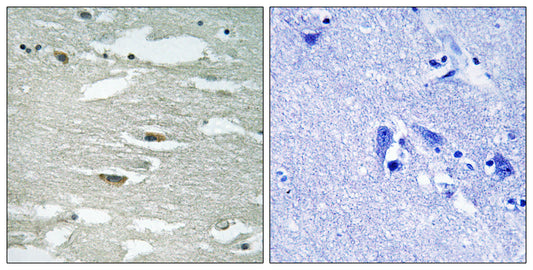 ILK (phospho Ser246) Rabbit Polyclonal Antibody