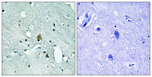 IP3R-I (phospho Ser1764) Rabbit Polyclonal Antibody