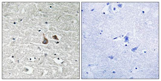 IRAK-1 (phospho Ser376) Rabbit Polyclonal Antibody