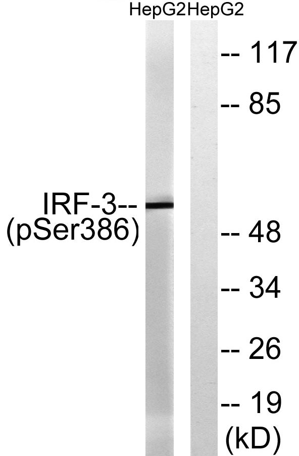 IRF-3 (phospho Ser386) Rabbit Polyclonal Antibody