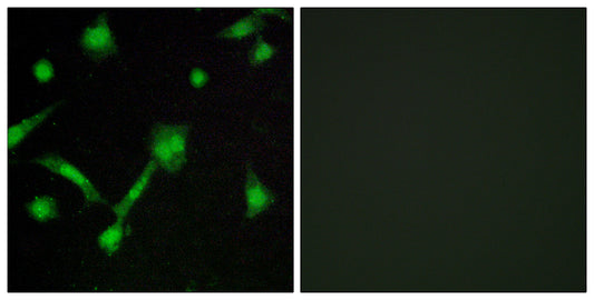 IκB-α (phospho Ser32/S36) Rabbit Polyclonal Antibody