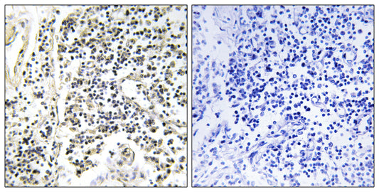IκB-α (phospho Tyr305) Rabbit Polyclonal Antibody