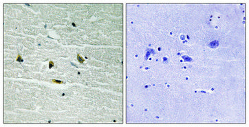 JAK2 (phospho Tyr119) Rabbit Polyclonal Antibody