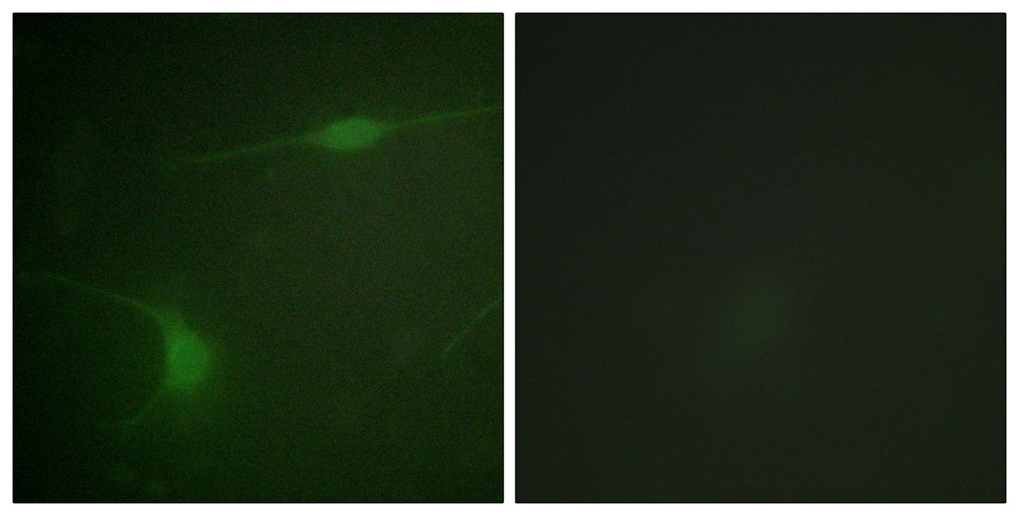 JIP-1 (phospho Thr103) Rabbit Polyclonal Antibody