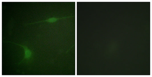 JIP-1 (phospho Thr103) Rabbit Polyclonal Antibody