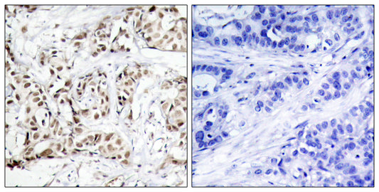 JNK1/2/3 (phospho Thr183) Rabbit Polyclonal Antibody