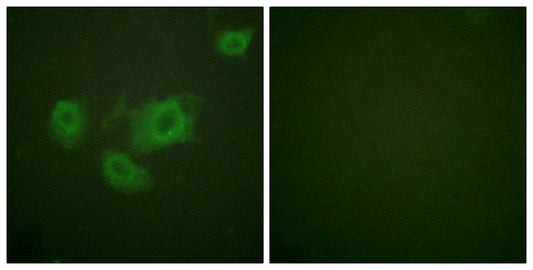 KIR6.2 (phospho Thr224) Rabbit Polyclonal Antibody