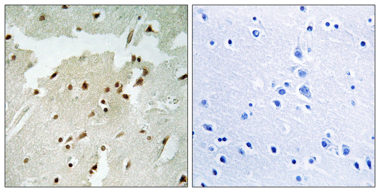 Ku-70 (phospho Ser5) Rabbit Polyclonal Antibody