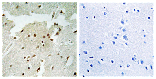 Ku-70 (phospho Ser5) Rabbit Polyclonal Antibody
