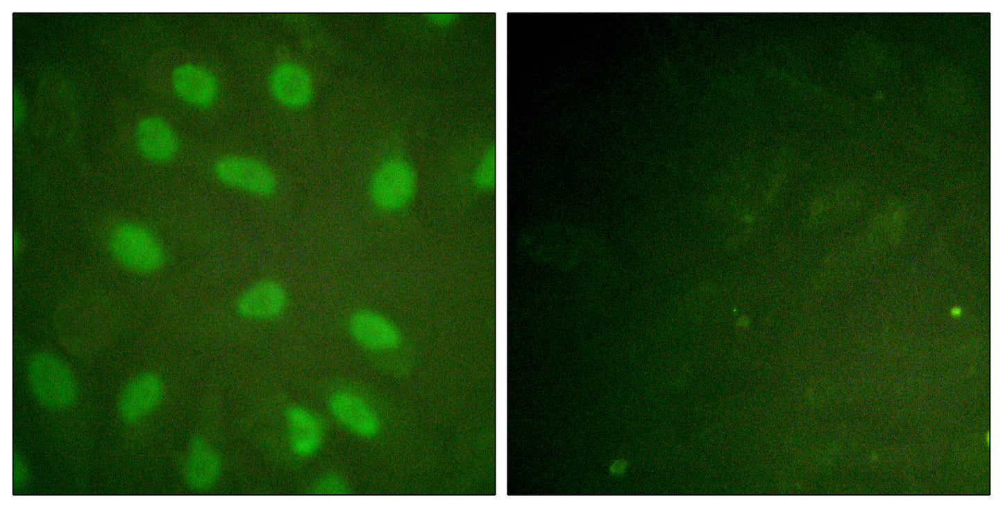 Ku-80 (phospho Thr714) Rabbit Polyclonal Antibody