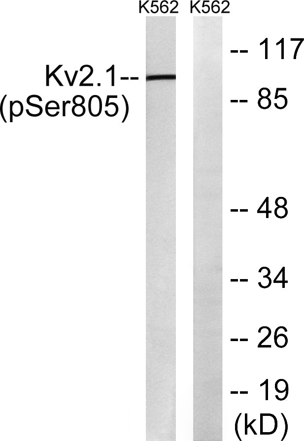 KV2.1 (phospho Ser805) Rabbit Polyclonal Antibody