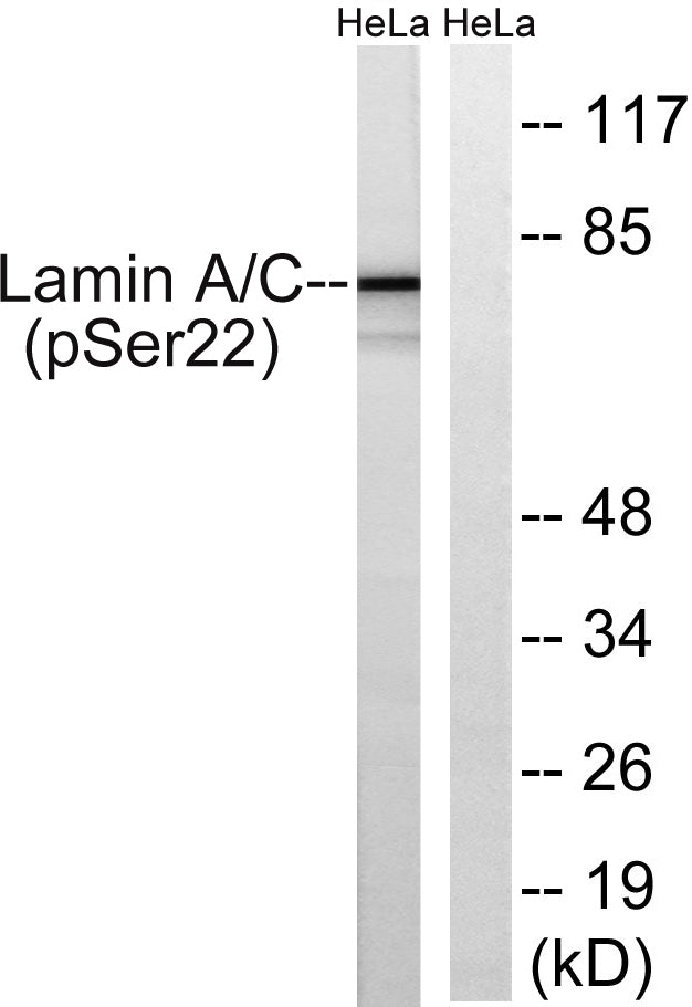 Lamin A/C (phospho Ser22) Rabbit Polyclonal Antibody