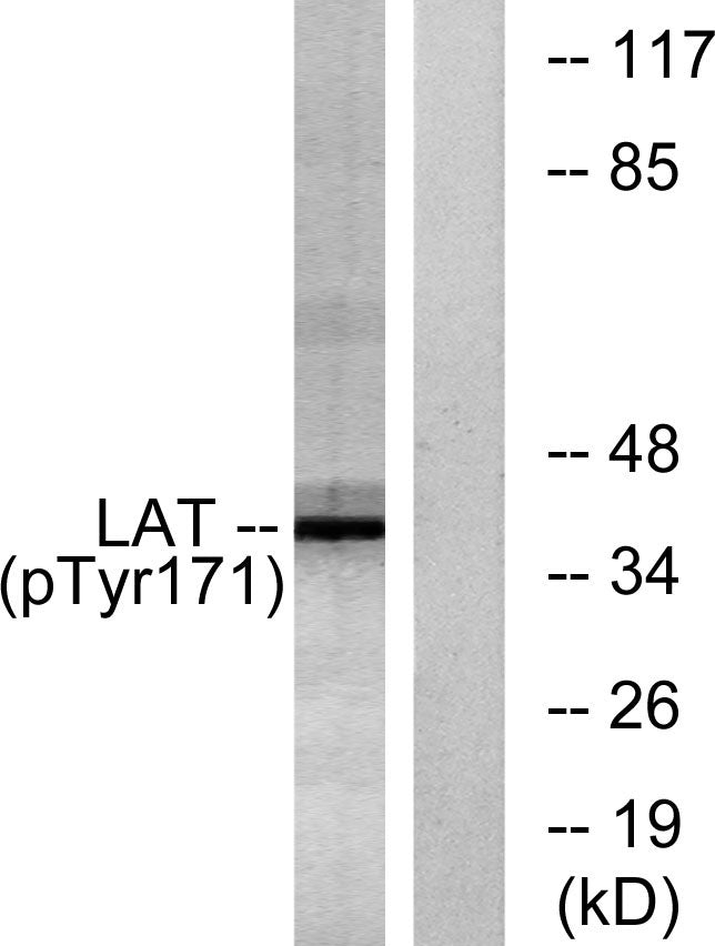 LAT (phospho Tyr200) Rabbit Polyclonal Antibody