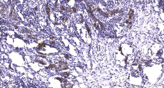 LATS1 (phospho-Ser909) Rabbit Polyclonal Antibody
