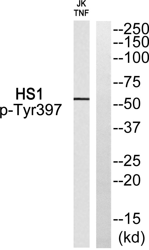 Lck BP-1 (phospho Tyr397) Rabbit Polyclonal Antibody
