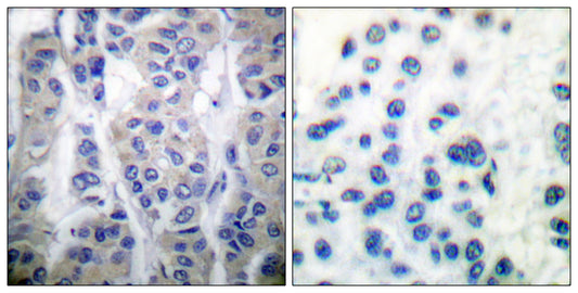 LIMK-1/2 (phospho Thr508/505) Rabbit Polyclonal Antibody