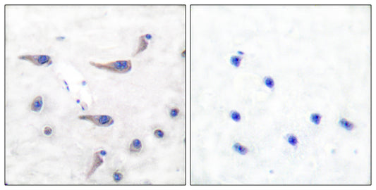 MARCKS (phospho Ser163) Rabbit Polyclonal Antibody
