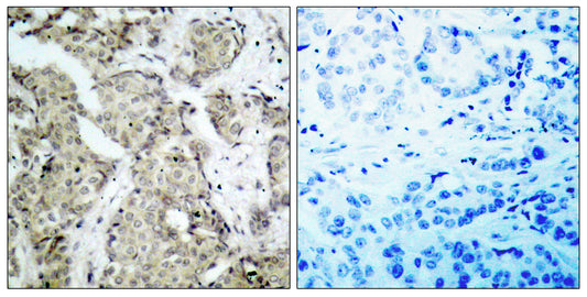 MEK-3 (phospho Ser218) Rabbit Polyclonal Antibody