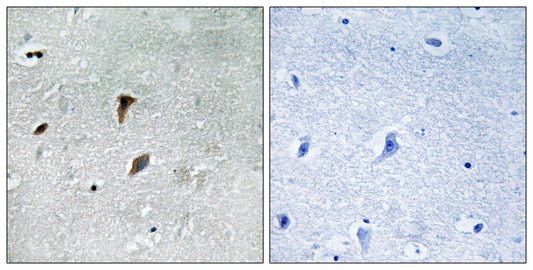 MEK-3 (phospho Thr222) Rabbit Polyclonal Antibody