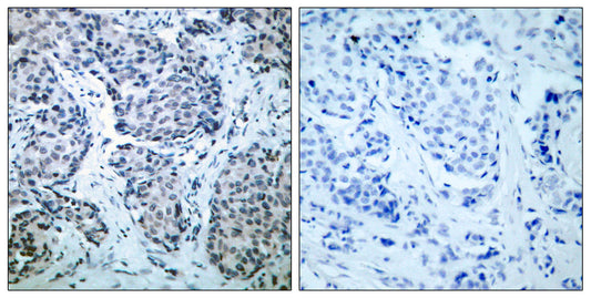 MEK-4 (phospho Thr261) Rabbit Polyclonal Antibody