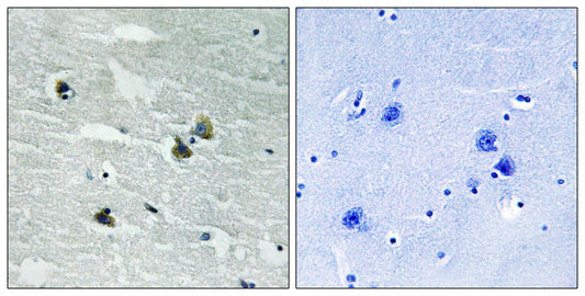 MerTK/Tyro3 (phospho Tyr749/681) Rabbit Polyclonal Antibody