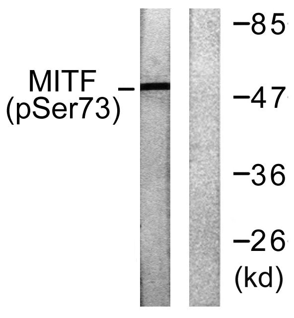 MITF (phospho Ser180) Rabbit Polyclonal Antibody