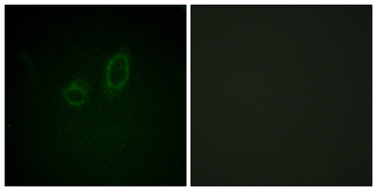 Moesin/Ezrin/Radixin (phospho Thr558) Rabbit Polyclonal Antibody