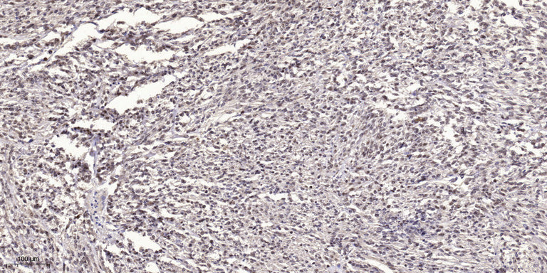 MYLK (phospho Tyr464) Rabbit Polyclonal Antibody