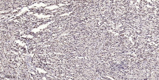 MYLK (phospho Tyr464) Rabbit Polyclonal Antibody