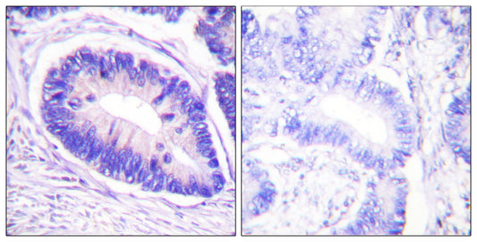 MYPT1 (phospho Thr853) Rabbit Polyclonal Antibody