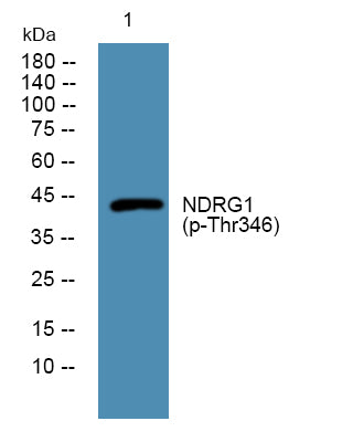 NDRG1 (phospho-Thr346)  Rabbit Polyclonal Antibody
