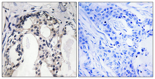 NF2 (phospho Ser10) Rabbit Polyclonal Antibody
