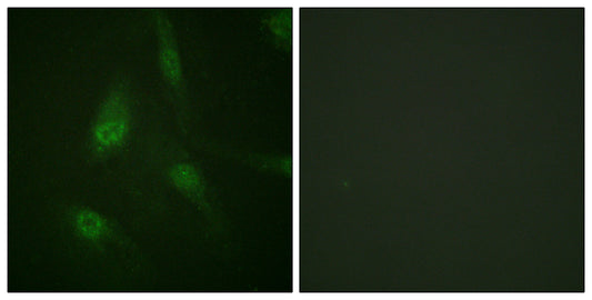 NFATc3 (phospho Ser165) Rabbit Polyclonal Antibody