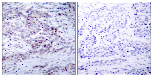 NFκB-p100 (phospho Ser869) Rabbit Polyclonal Antibody